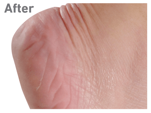 O'KEEFFE'S (FOR HEALTHY FEET CREAM) - Image 7